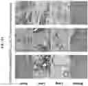 Fig. 10 - Adeno-associated virus (AAV) clade f vector and uses therefor