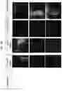 Fig. 14 - Adeno-associated virus (AAV) clade f vector and uses therefor
