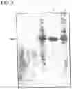 Fig. 04 - PURIFICATION OF PROTEINS WITH CATIONIC SURFACTANT