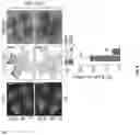 Fig. 16 - COMPOSITIONS COMPRISING SASP MODULATORS AND SENESCENCE ATTENUATORS AND USES THEREOF FOR MODULATING CELLULAR SENESCENCE