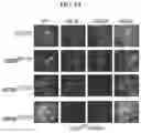Fig. 07 - Minigene therapy