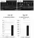 Fig. 08 - Compositions and methods for the diagnosis and treatment of lymphatic system disorders