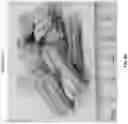 Fig. 05 - Method to liquefy biomass
