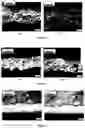 Fig. 05 - METHOD OF MAKING NON-GALLING PARTS USING AMORPHOUS METAL SURFACES