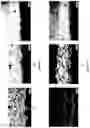 Fig. 07 - METHOD OF MAKING NON-GALLING PARTS USING AMORPHOUS METAL SURFACES