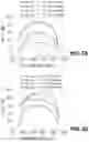 Fig. 07 - Photoelectrochemical cell
