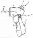 Fig. 01 - Portable stain removal device