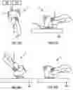 Fig. 11 - Portable stain removal device