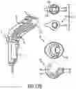 Fig. 15 - Portable stain removal device