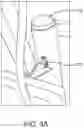 Fig. 04 - Expandable Containment Plow