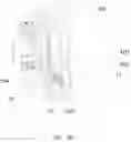 Fig. 10 - Leak-proof device for water inlet valve