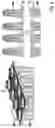Fig. 05 - Trenching unit, trenching body and insert