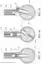 Fig. 17 - Pin tumbler lock