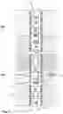 Fig. 02 - System for stimulating a well