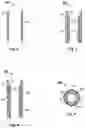 Fig. 03 - System for stimulating a well