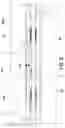 Fig. 06 - Pipe for cableless bidirectional data transmission and the continuous circulation of stabilizing fluid in a well for the extraction of formation fluids and a pipe string comprising at least one of said pipes