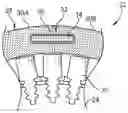 Fig. 01 - Brazed blade track for a gas turbine engine