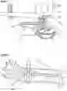 Fig. 11 - Method for assembling a wind turbine and a wind turbine system