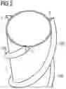 Fig. 03 - Vortex-shedding-arrangement