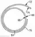 Fig. 01 - Co-molded metallic fan case containment ring
