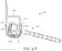 Fig. 04 - Attachment device and related methods