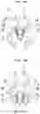 Fig. 03 - PISTON VALVE-SEALING STRUCTURE AND PISTON VALVE FLUID CONTROL METHOD