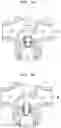 Fig. 06 - PISTON VALVE-SEALING STRUCTURE AND PISTON VALVE FLUID CONTROL METHOD