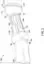 Fig. 03 - Orthotic device for use with user-operated tool