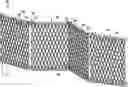 Fig. 01 - Razor wire container with access opening