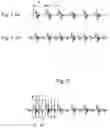 Fig. 04 - Condition diagnosing system for rolling guide device