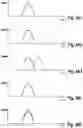 Fig. 04 - PARTICLE SENSOR INCLUDING AT LEAST TWO LASER DOPPLER SENSORS