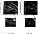 Fig. 12 - Multifocal photoacoustic microscopy through an ergodic relay