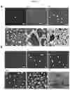 Fig. 08 - Plasmo photoelectronic immunosensor