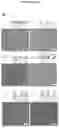 Fig. 14 - Plasmo photoelectronic immunosensor