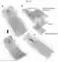 Fig. 19 - Plasmo photoelectronic immunosensor