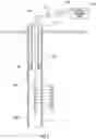 Fig. 02 - REDUCTION OF CORE RESPONSE DEPENDENCE ON RADIUS OF FIRST PIPE IN CORROSION DETECTION TOOLS