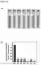 Fig. 16 - Aluminum ion detector, method of manufacturing the same, and aluminum ion detection method using the same