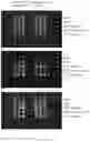 Fig. 08 - ASSAY FOR C5B-9 DEPOSITION IN COMPLEMENT-ASSOCIATED DISORDERS