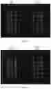 Fig. 10 - ASSAY FOR C5B-9 DEPOSITION IN COMPLEMENT-ASSOCIATED DISORDERS