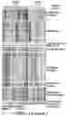 Fig. 03 - Methods related to bronchial premalignant lesion severity and progression