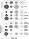 Fig. 04 - Methods related to bronchial premalignant lesion severity and progression