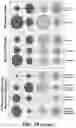 Fig. 05 - Methods related to bronchial premalignant lesion severity and progression