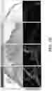 Fig. 07 - Methods related to bronchial premalignant lesion severity and progression