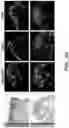 Fig. 17 - Methods related to bronchial premalignant lesion severity and progression
