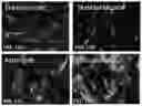 Fig. 22 - Methods of differentiating preadipocytes and uses thereof