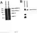 Fig. 03 - NON-INVASIVE ENZYME SCREEN FOR TISSUE REMODELLING-ASSOCIATED CONDITIONS