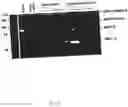 Fig. 04 - NON-INVASIVE ENZYME SCREEN FOR TISSUE REMODELLING-ASSOCIATED CONDITIONS