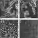 Fig. 01 - Methods for single-cell prostate tissue classification and prediction of cancer progression