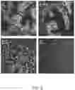 Fig. 03 - Methods for single-cell prostate tissue classification and prediction of cancer progression