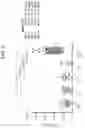 Fig. 09 - METHODS FOR QUANTIFYING INTER-ALPHA INHIBITOR PROTEINS